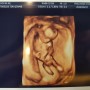 임신 중기 4개월 (임신12주차~임신15주차)증상 및 경험담