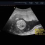 임신 중기 5개월 (임신16주차~임신19주차)증상 및 경험담