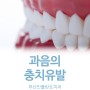 남포동치과추천 :: 과음으로 인한 충치, 치아질환 예방하는 방법은?
