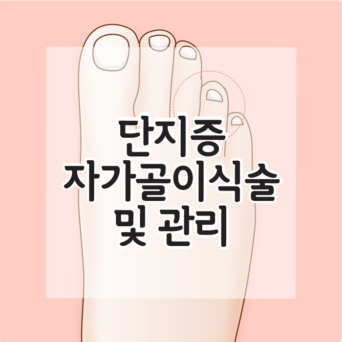 단지증 수술 자가골이식술 및 수술 후 관리[광명새움병원 김응수원장] : 네이버 블로그