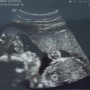 임신 중기 6개월 (임신20주차~임신23주차)증상 및 경험담