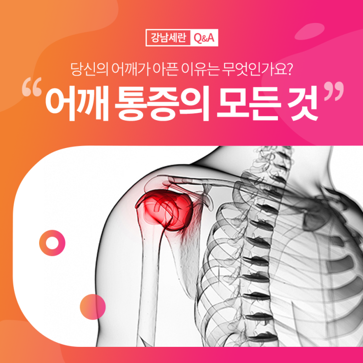 [어깨통증의 모든것!] 당신의 어깨가 아픈 이유는 무엇인가요? : 네이버 블로그