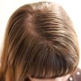 얇은, 연모화된 머리카락을 다시 두껍게 만들어줄 수 있는 방법?