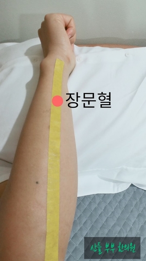 [아현동 한의원] 알아두면 유용한 구급혈자리 - (1) 갑작스런 설사에는 장문혈! : 네이버 블로그