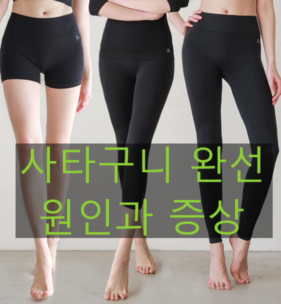 사타구니 완선 연고를 바르면 개선됩니다. : 네이버 블로그