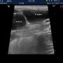 대전 강아지 자궁축농증(pyometra) 수술, 리본동물병원