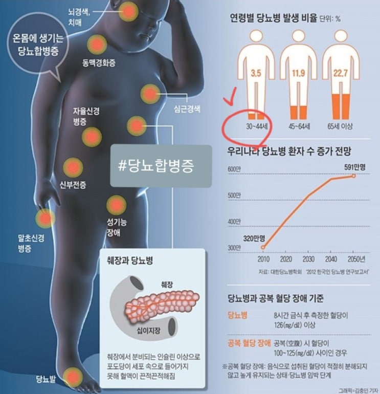 당뇨 식이요법! 왜 필요할까요? 합병증예방이 답입니다. : 네이버 블로그