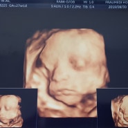 임신 중기 7개월 (임신24주차~임신27주차)증상 및 경험담