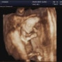 〔탄탄이♥〕 임신 12주차 : 증상과 1차 기형아 검사!