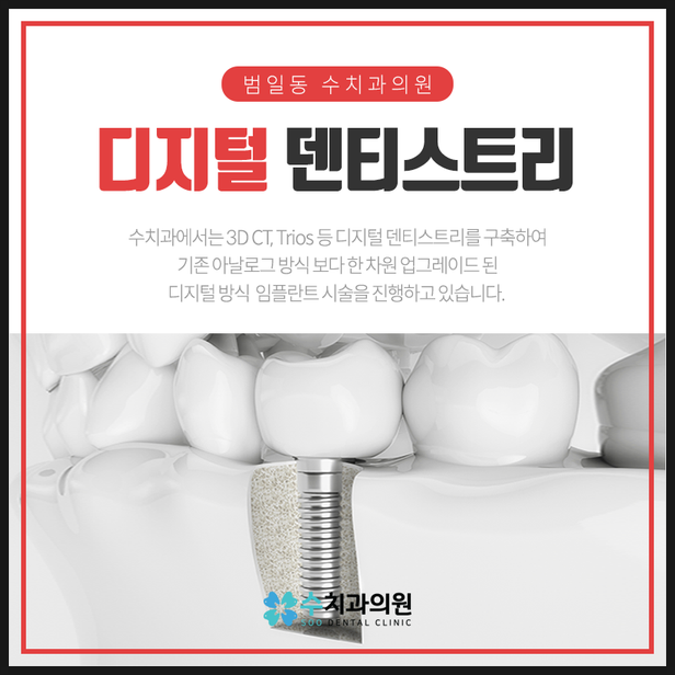 부산서면치과는 임플란트 뼈 이식잇몸 상태 나쁠수록 의료진 노하우 중요하게 생각합니다. : 네이버 블로그 부산서면치과는 임플란트 뼈 이식잇몸 상태 나쁠수록 의료진 노하우 중요하게 생각합니다. : 네이버 블로그