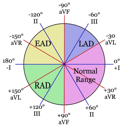 QRS axis: 이행대(transitional zone), axis deviation : 네이버 블로그