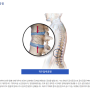 척추압박골절 - 연세바른병원
