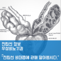 구미 우성비뇨기과, '전립선 비대증에 관해 알아봅시다.' 대본 내용 정리.