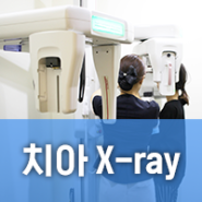 치아 엑스레이 촬영의 중요성