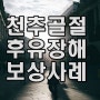 천추골절 후유장해 보상 사례