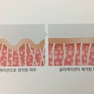 글리케이션과 노화