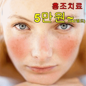 ☆홍조 레이저 부산 최저가☆ 겨울철 불청객 안면홍조 이제는 고민만하지 말고 한방에 해결하세요. 해운대 스펀지성형외과의원 / 부산 ...