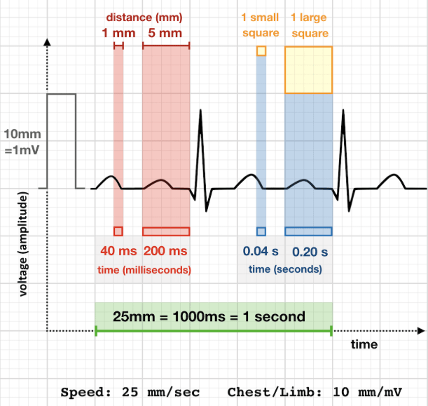 ecg-rr-heart-rate