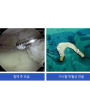 반월상연골이식술 - 연세바른병원 정형외과