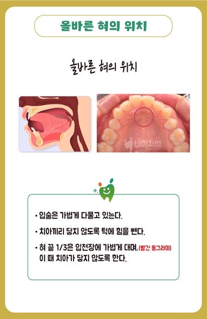 얼굴 이뻐지기, 뮤잉(Mewing)13일차 부작용/다시 1일차 : 네이버 블로그