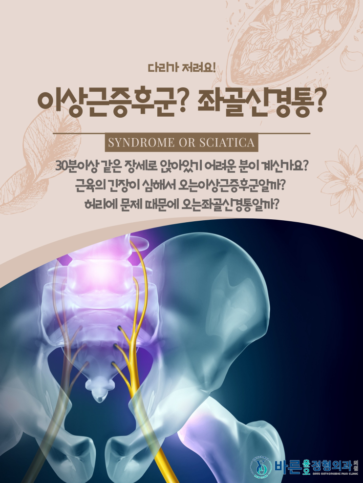 다리가 저려요! - 이상근증후군? 좌골신경통?[바른윤오정형외과] : 네이버 블로그