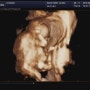 〔탄탄이♥〕 임신 16주차 (5개월) : 증상과 2차 기형아 검사!