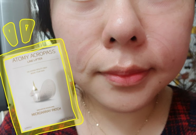 피부과 대신 애터미 '아크로패스 라인리프터(ACROPASS LINE LIFTER)' 리뷰 : 네이버 블로그