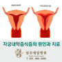 자궁내막증식증의 원인과 치료, 일산난임관련수술