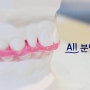 [분당치과] 치과진료의 시작과 끝은 치아교합이 중요!