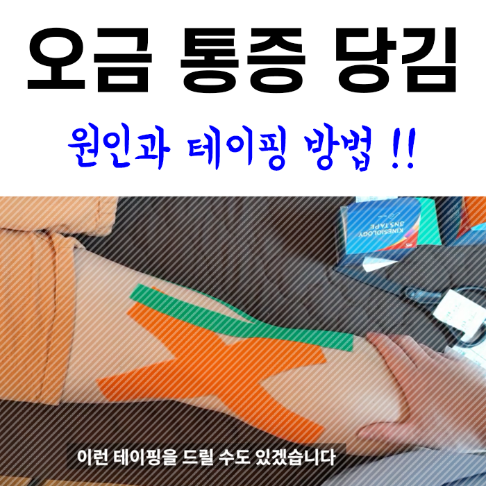 오금 통증(무릎 뒤쪽 통증) 원인과 테이핑[영상첨부] : 네이버 블로그