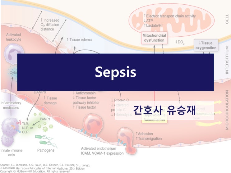 패혈증 (Sepsis) : 네이버 블로그