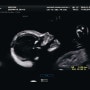 [임신5개월] 둘째, 임신 중기 먹덧 + 20주 정밀 초음파 + 성별 확정