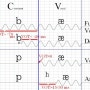 VOT(Voice Onset Time) 성대진동 시작 시간