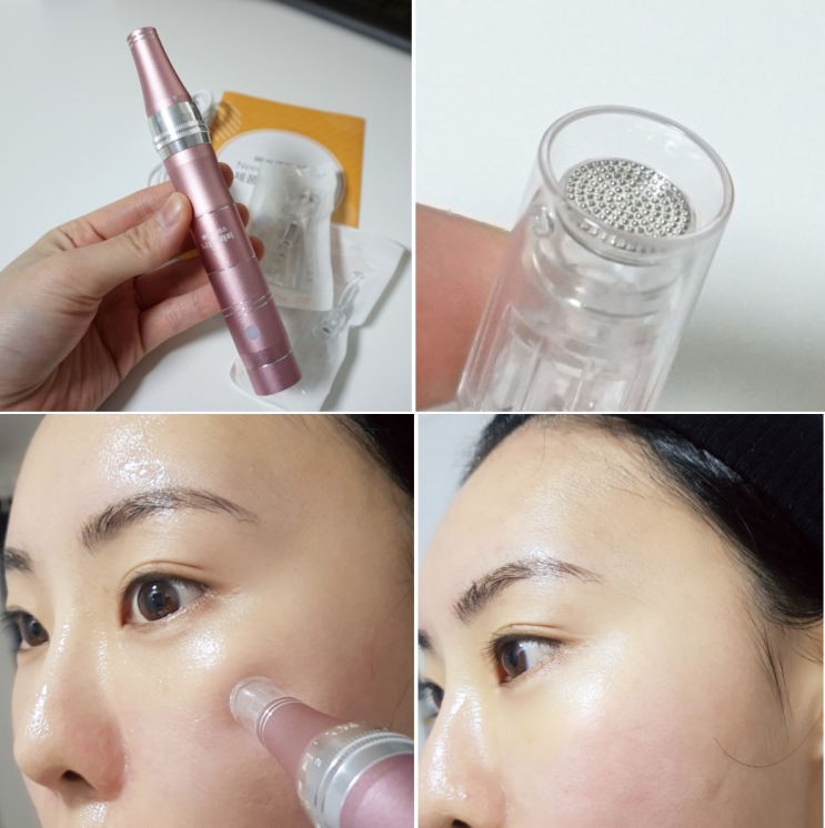 MTS초보자도 할수있다! 사용방법 및 효과 : 네이버 블로그
