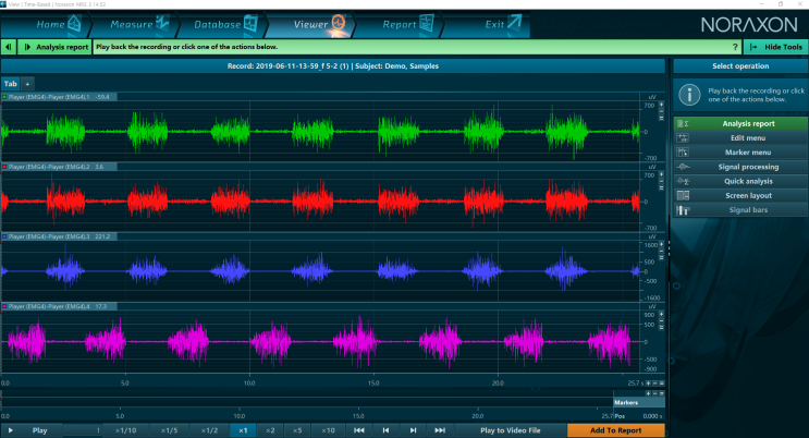 7. MR3 근활성도 Signal Processing 처리 방법 : 네이버 블로그