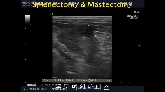 Splenectomy & Mastectomy 비장절제 & 유선종양수술 : 천안 동물병원닥터스 : 네이버 블로그