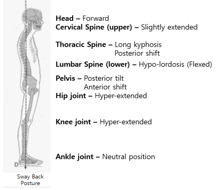체형교정 Sway Back Posture I 논현역필라테스 I 신논현역필라테스 I 뉴온필라테스 네이버 블로그