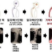 메이플 노가다 근황