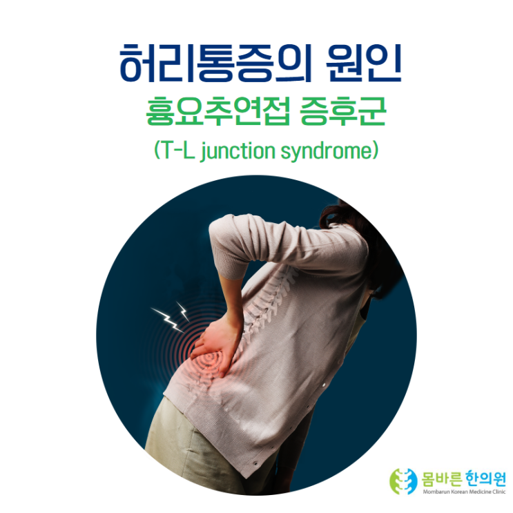 [강동구 천호 한의원] 허리통증, 골반위 엉덩이 통증의 원인 – 흉요추연접 증후군(T-L junction syndrome ...