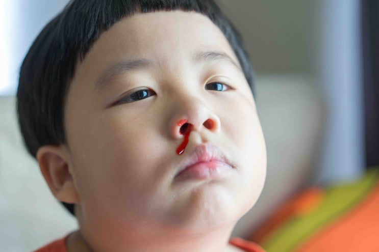 코피 자주 나는 아이 원인 : 네이버 블로그