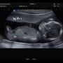 임신 17주 18주 임신5개월