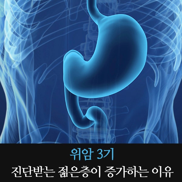 위암3기 진단받는 젊은층이 증가하는 이유 : 네이버 블로그