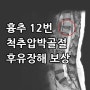 흉추 12번 척추압박골절 원인과 후유장해 보상 알아보기