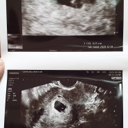 [임신일기] 임신 초기 증상(feat.입덧) + 첫 산부인과 방문 5주, 그리고 두번째 방문 8주 일상 주저리 주저리