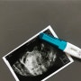 나의 임신기간/ 출산 기록