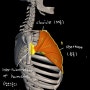 상부교차증후군(upper crossed syndrom)에 관여하는 근육들