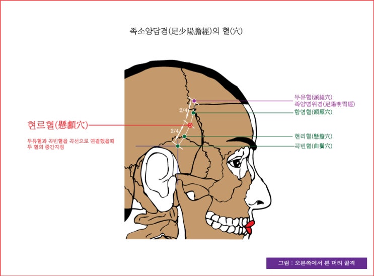 족소양담경(足少陽膽經)의 현로혈(懸顱穴), 함염혈(頷厭穴), 객주인혈(客主人穴)[상관혈(上關穴)] - 동의보감(東醫寶鑑 ...