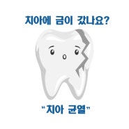 [강서구치과]치아에 금이가고 있다면?