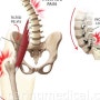 고관절의 기능부전 및 통증 Hip Joint dysfunction & uncomfortable [방배동 내방역 & 인천 논현동 스포츠재활/개인트레이닝/피티 전문 소마루트바디밸런스]