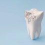 < 치아 균열 vs 치아 파절 > 4. 치아가 깨졌어요.